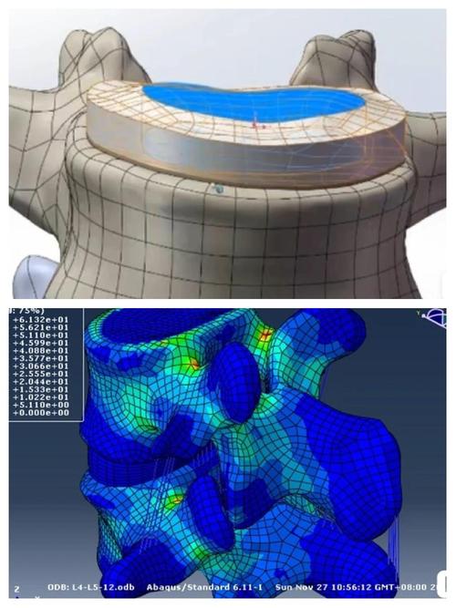 如何构建医学有限元鼻上颌骨复合体的三维有限元模型？