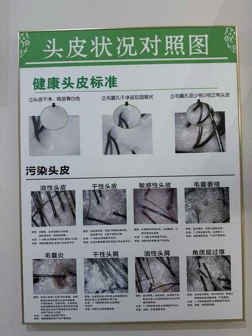 头发护理项目之间有哪些区别与联系？如何体现它们之间的内在关联？
