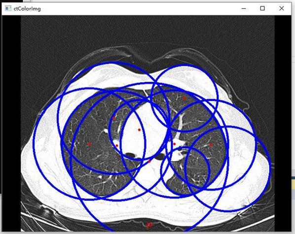 如何用OpenCV实现多个圆形检测的算法？