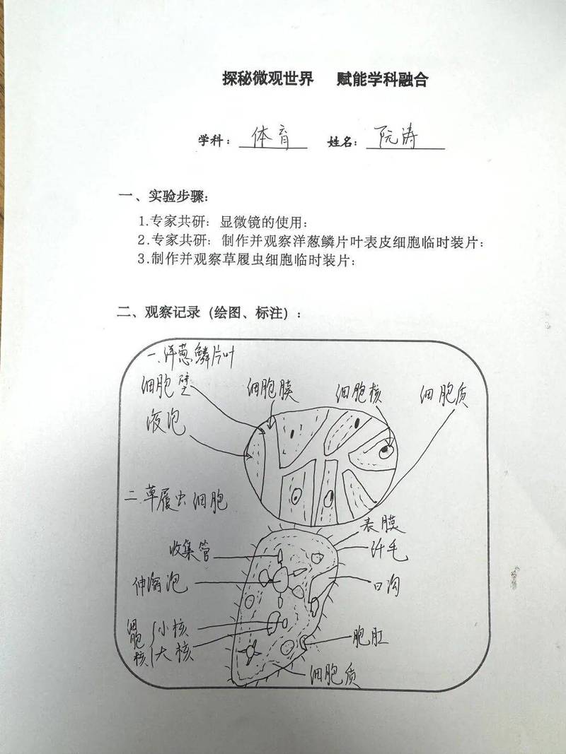 如何运用主动轮廓模型与贝叶斯法识别并实现肺实质分割？