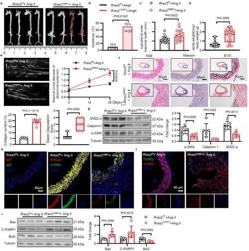 ECMAScript 2020新增特性有哪些，能否详细列举一下？