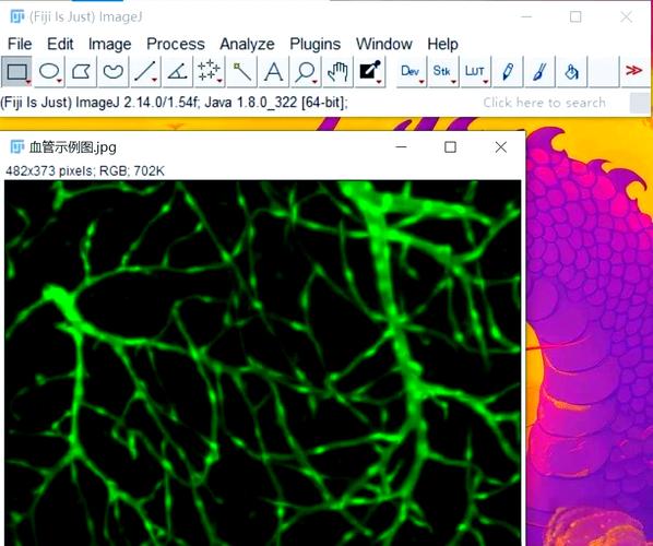 如何用Hessian特征和Frangi滤波在Matlab中实现血管图像的图像增强？