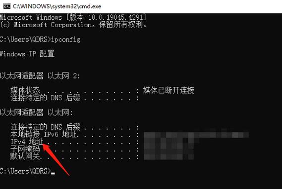 如何快速查询本机公网IP和VPN连接IP，有效提升网络使用效率？