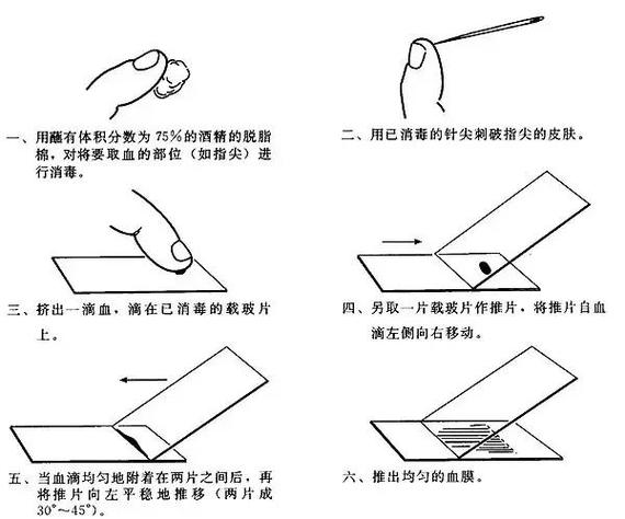 如何使用Keras实现slice layer切片层功能？