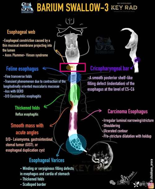 Ruby on Rails架构中，思维狮身人面像的哪些不匹配问题该如何解决？