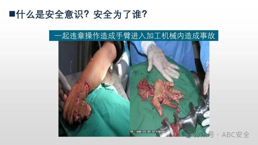 为什么Jedis连接池未释放会导致如此严重的生产事故？