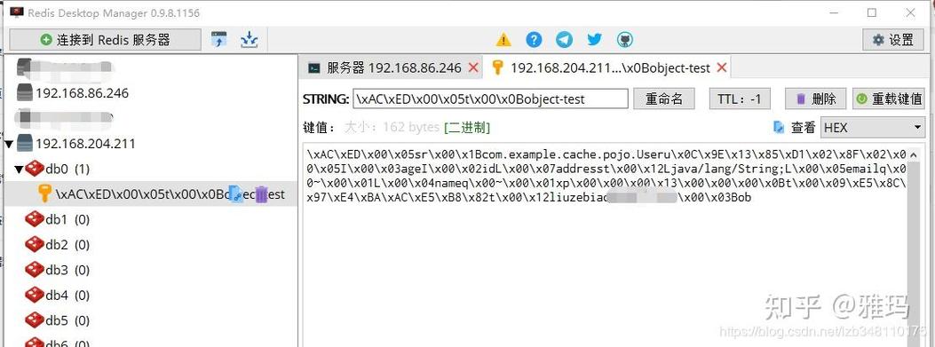 SpringCache如何与Redis缓存结合实现高效数据缓存？