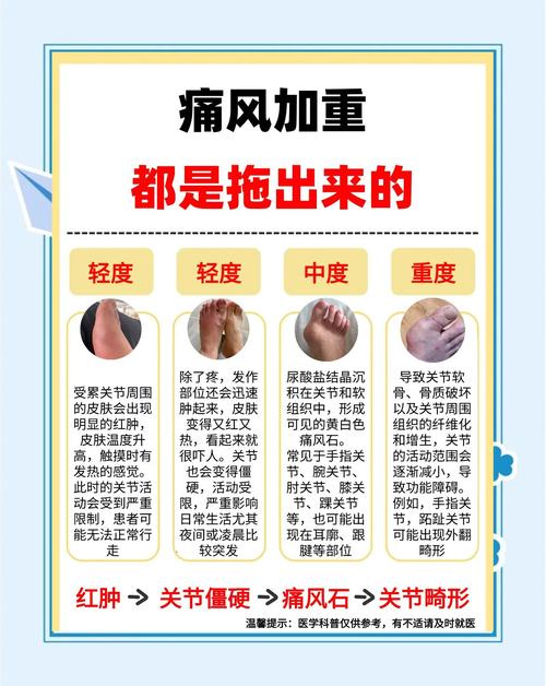 痛风症状有哪些具体表现？如何识别和预防痛风发作？