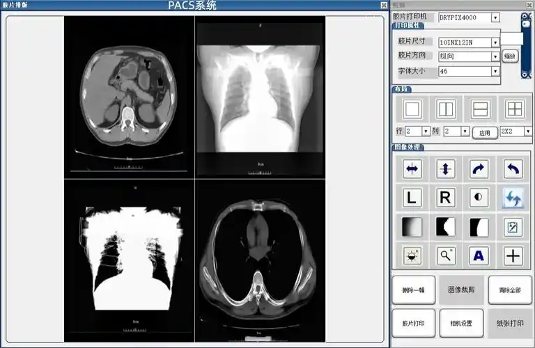医院影像PACS系统如何实现三维重建技术？