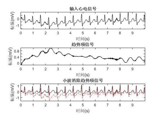 如何利用Matlab源码实现多种滤波去除心电信号基线漂移？