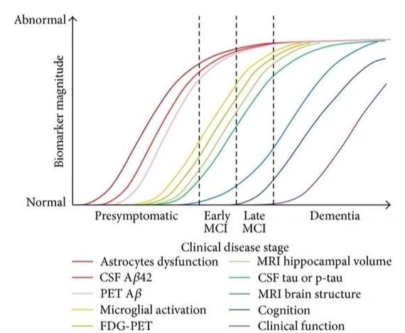 如何利用基于t分布随机邻域嵌入构建阿尔茨海默症诊断的长尾词模型？