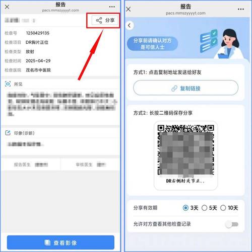 云胶片数字影像存储需要哪种专业数据库？