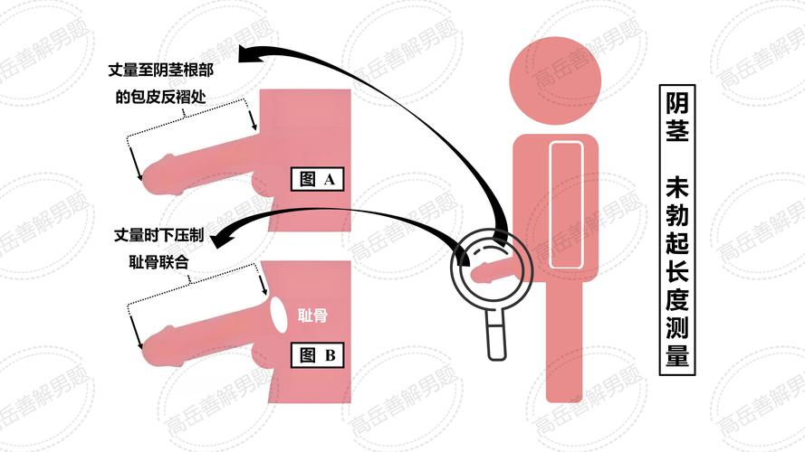 Mybatis DAO实现具体步骤有哪些详细讲解？