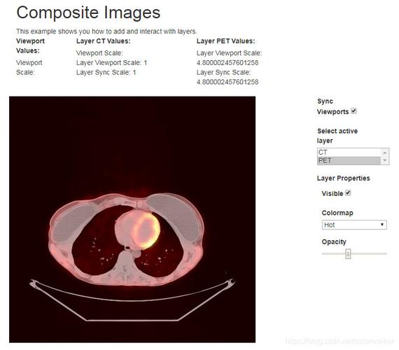 如何利用cornerstone.js实现dicom医学影像的长尾词浏览功能？