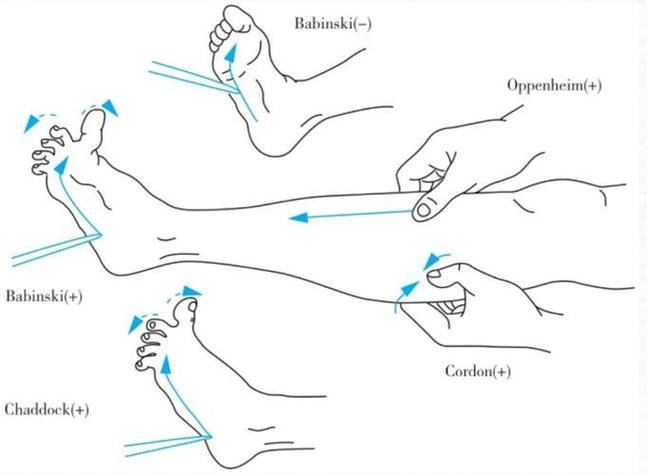 如何运用Golang reflect实现复杂类型反射操作？