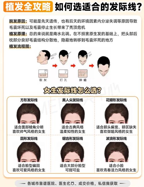 植发项目有哪些区别与联系，如何挑选最适合我的方案？