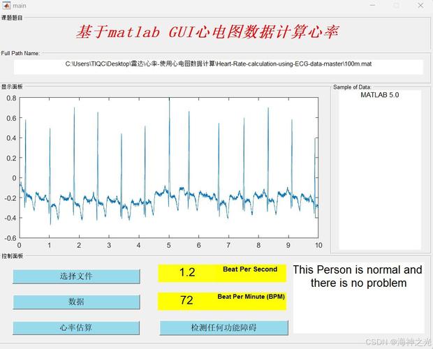 如何利用小波变换DWT在Matlab中计算ECG信号的心率？