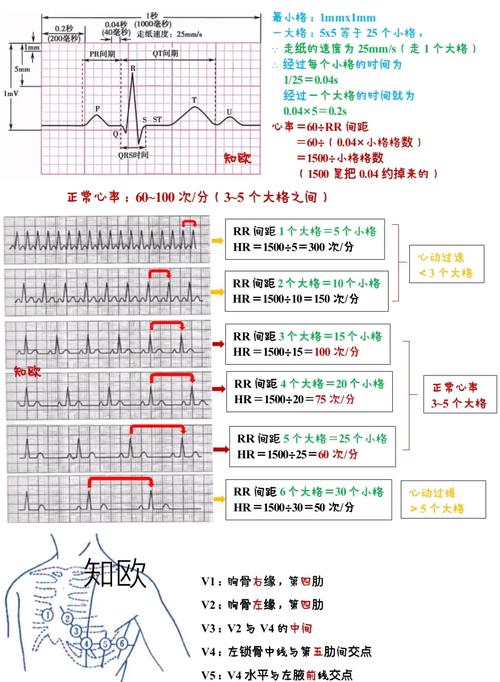 如何改写WPF心电图曲线绘制代码以适应长尾需求？