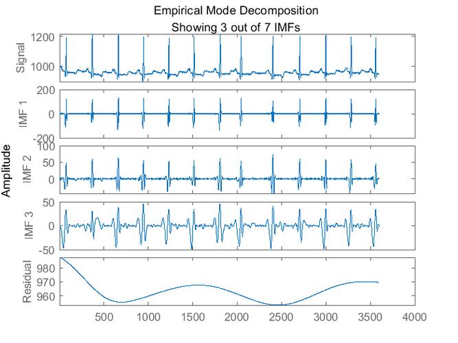 如何利用小波变换DWT在Matlab中计算ECG信号的心率？
