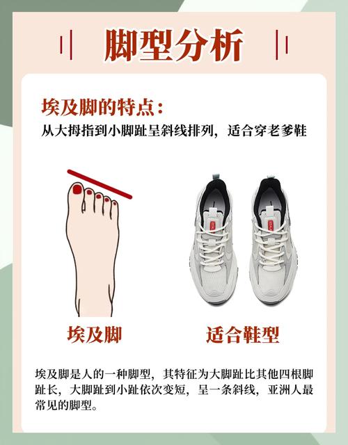 如何根据脚型选择合适的鞋子？