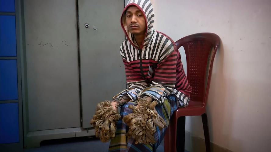 人身上能长出树枝吗？这男子却奇迹般做到了！