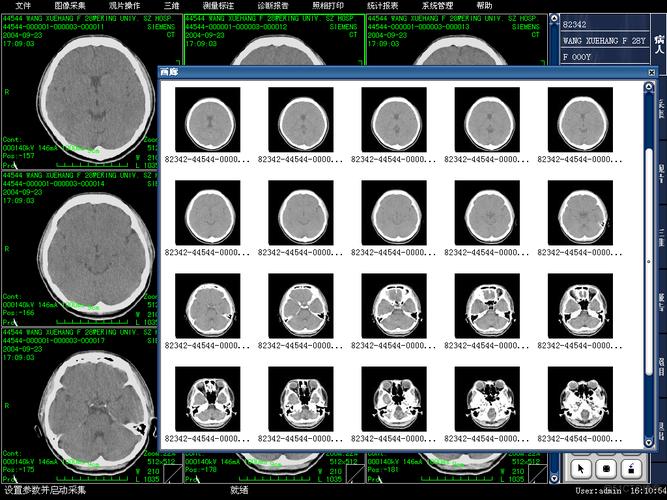 数字医学通用标准DICOM究竟是什么？