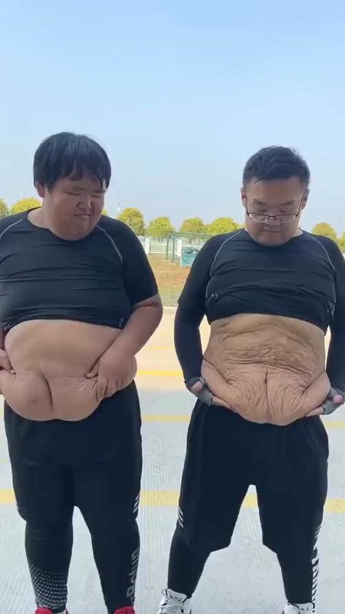 减重270斤后为爱去松弛皮肤的小伙，现在生活得怎么样了？