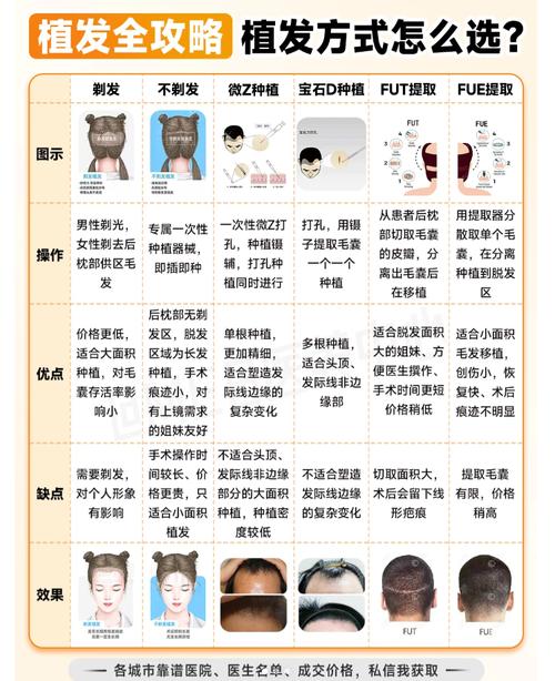 植发项目有哪些区别与联系，如何挑选最适合我的方案？
