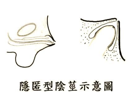 类型-表中那个Lua表为何全为零，难道是隐藏了什么秘密？