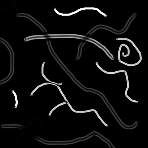 如何用Hessian特征和Frangi滤波在Matlab中实现血管图像的图像增强？