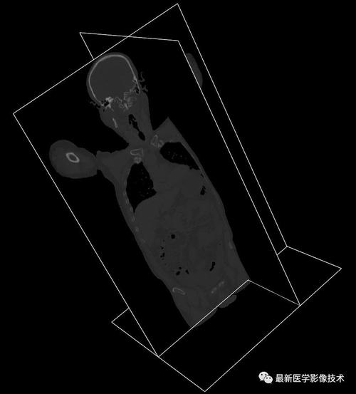 医学图像处理案例四：如何构建人体骨骼与肺组织三维模型实例？