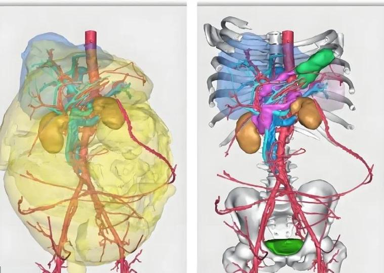 三维重建究竟有何神奇之处，在哪些领域大显身手？